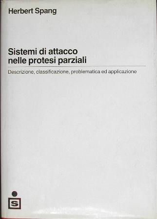 Sistemi di attacco nelle protesi parziali. Descrizione, classificazione, problematica ed applicazione